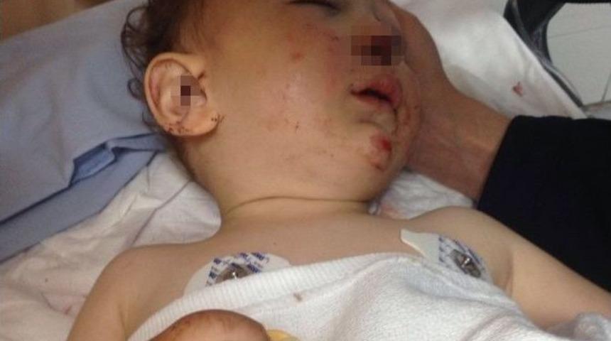 Ankara&rsquo;da 16 Aylık Bebek 3. Kattan Merdiven Boşluğuna D&uuml;şt&uuml;