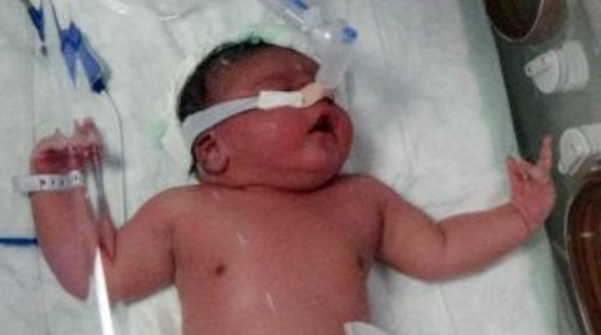 5 Kilo 750 Gram Doğan Bebek Şaşırttı
