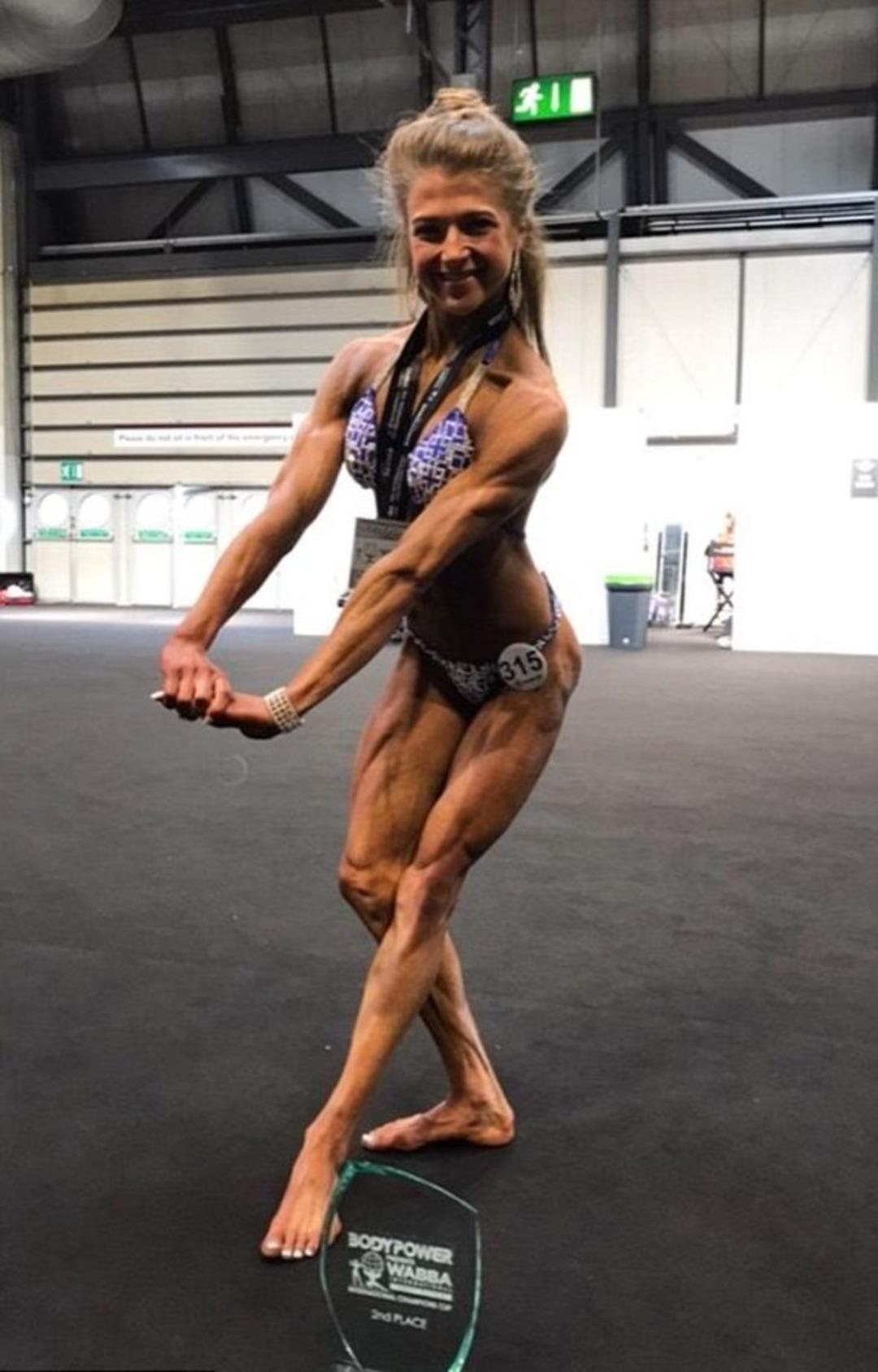 Anoreksiya hastasıydı, v&uuml;cut geliştirme şampiyonu oldu! 