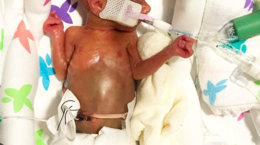 Kutu kola boyunda doğan bebeğin şimdiki haline inanamayacaksınız!