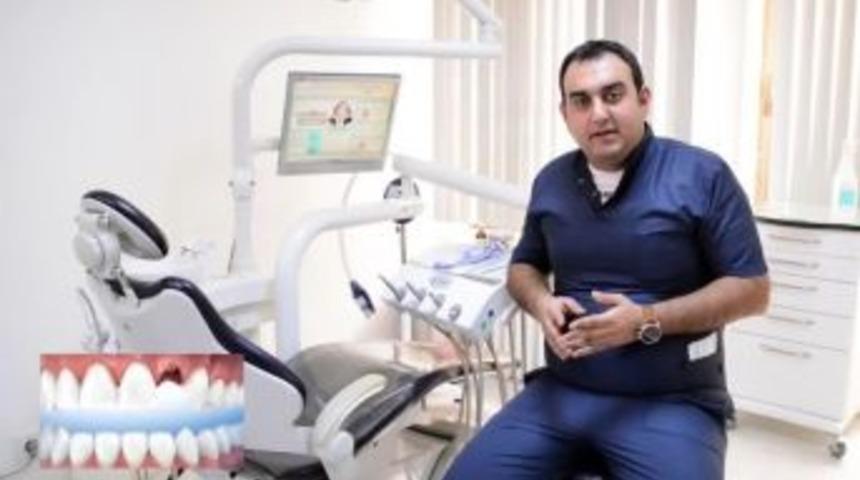 Ağız Ve Diş Sağlığında Doğru Bilinen Yanlışlar