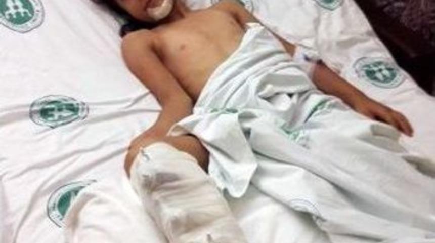 Kandıra&rsquo;da İki Ayrı Kazada 2 &Ccedil;ocuk Yaralandı