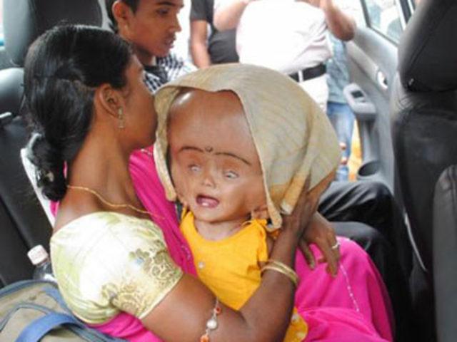 Mucize ger&ccedil;ekleşti 3