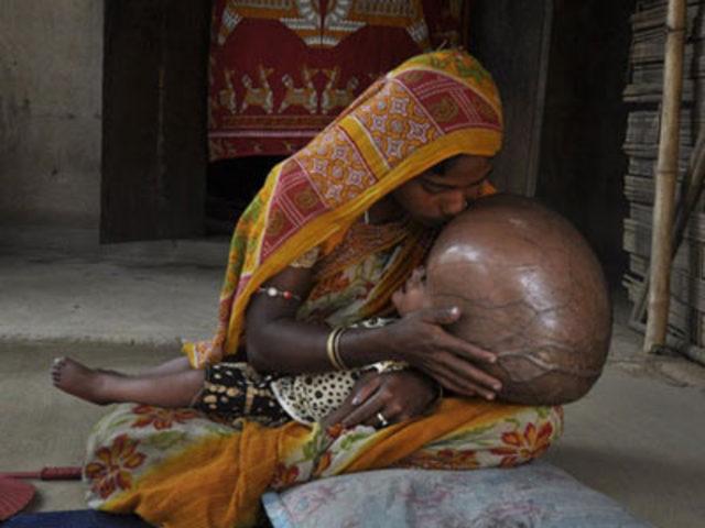 Mucize ger&ccedil;ekleşti 4