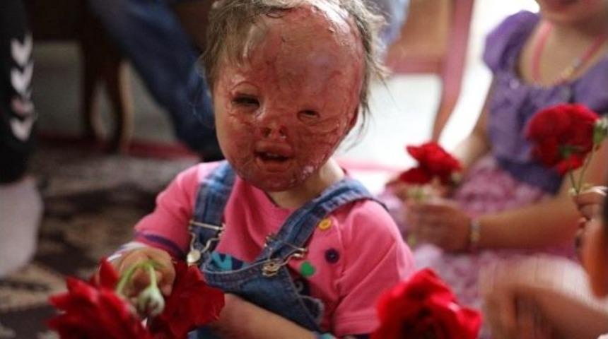 Suriyeli &Ccedil;ocukların Dramı