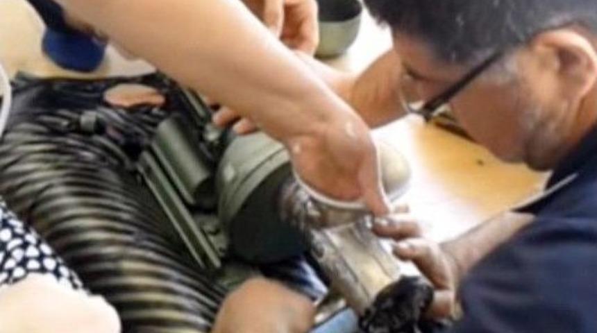 Elini Kaptırdığı Kıyma Makinesiyle Hastaneye Kaldırıldı