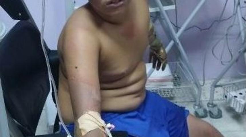 &Ccedil;akmak Gazı Patlayınca 3 &Ccedil;ocuk Yaralandı