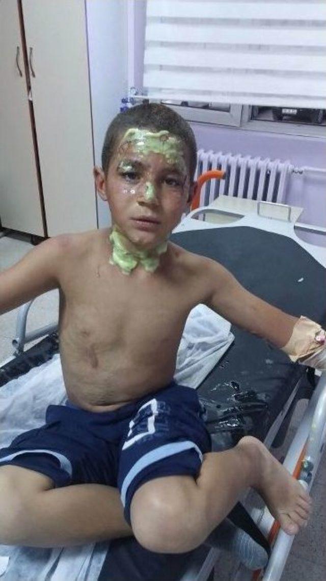Çakmak Gazı Patlayınca 3 Çocuk Yaralandı