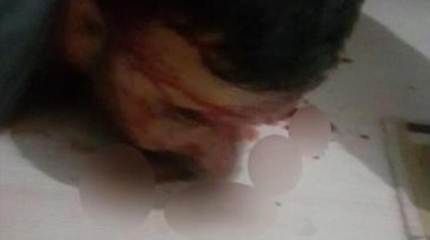 Darbeci Albayların Yakalanma Anına Ait Fotoğraflar