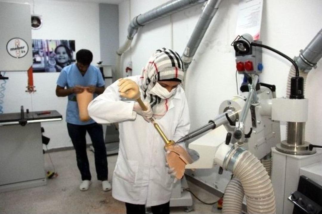 Suriye&rsquo;deki Savaşta Kolunu Ve Bacağını Kaybedenlere &Uuml;cretsiz Tedavi