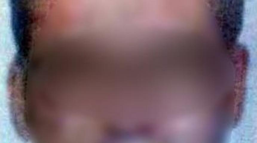 Anestezi Teknisyeninden Baygın Haldeki Hastaya Cinsel Taciz İddiası