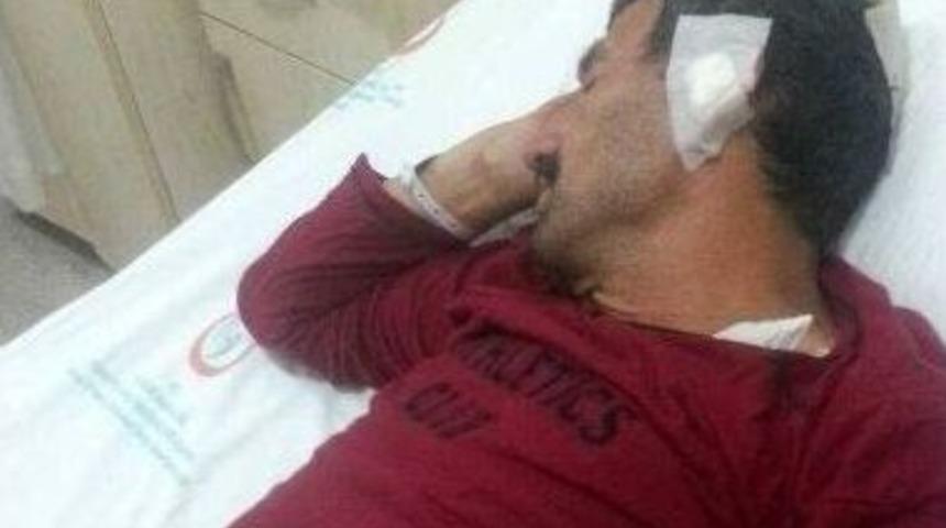 Kestiği Ağacın Altında Kaldı