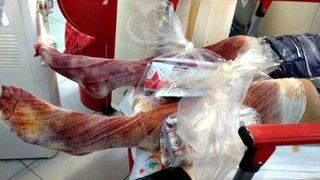 Bartın’da Teknede Patlama: 1 Yaralı