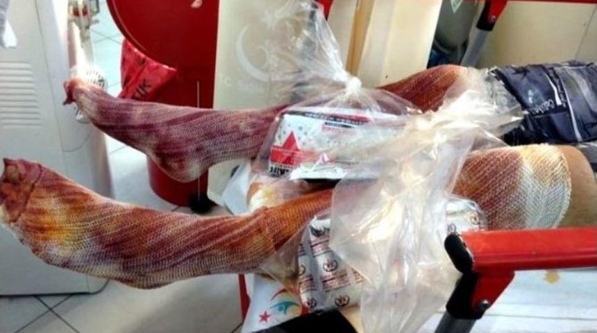 Bartın’da Teknede Patlama: 1 Yaralı