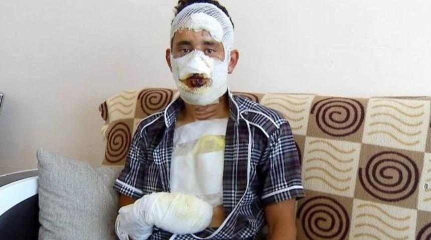 Terhisine 2 Ay Kalan Askerin &Uuml;zerine Kolonya D&ouml;k&uuml;lerek Yakıldığı İddia Edildi