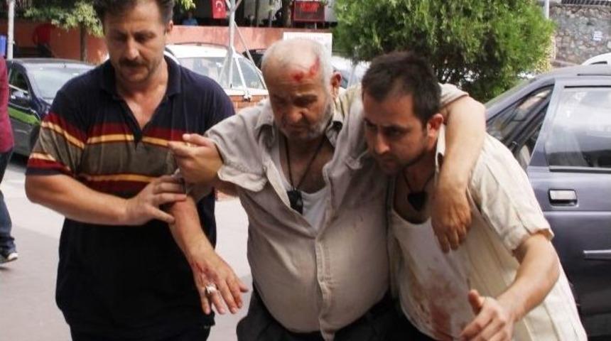 Elini Kesen Acemi Kasap Durumuyla Dalga Ge&ccedil;ti