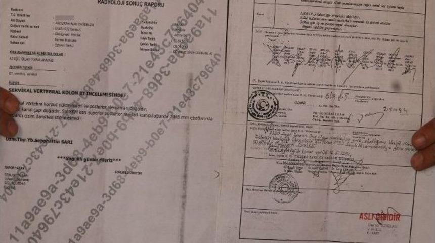 (&ouml;zel Haber) 23 Yıldır Kafasındaki Kurşunla Yaşıyor