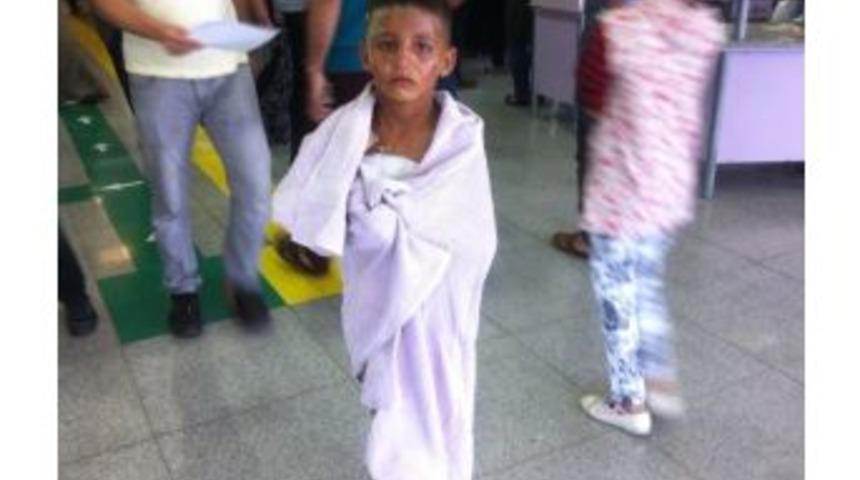 &Uuml;zerine Kaynar Su D&ouml;k&uuml;len &Ccedil;ocuk Hastaneye Y&uuml;r&uuml;yerek Girdi