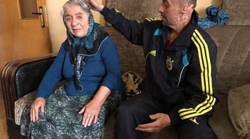 (&ouml;zel Haber) L&ouml;semili Hastası, Engelli Annesi İ&ccedil;in Yardım İstiyor