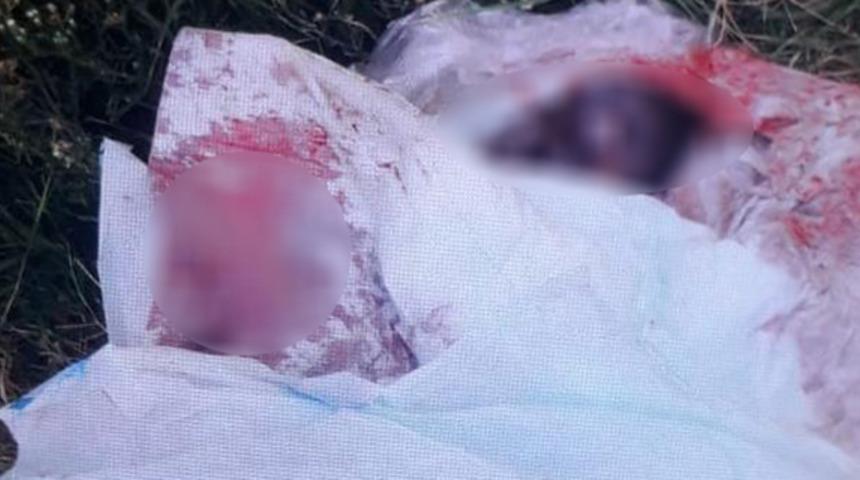 İstanbul Esenyurt'ta çöp konteynerinin yanında yeni doğmuş bebek cesedi bulundu!