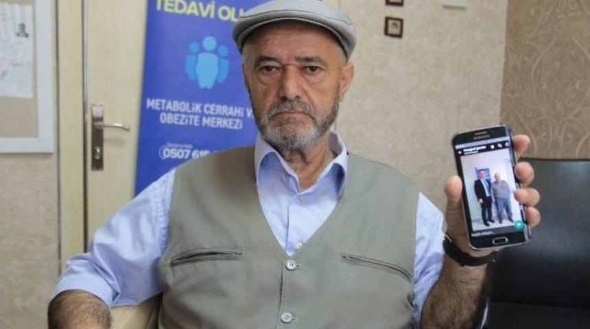 T&uuml;p Mide Ameliyatı İle 49 Kilo Verdi