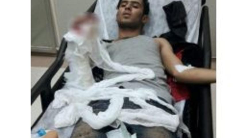 Elinde Bomba Patlayan Ş&uuml;pheli Hastanede G&ouml;zaltına Alındı