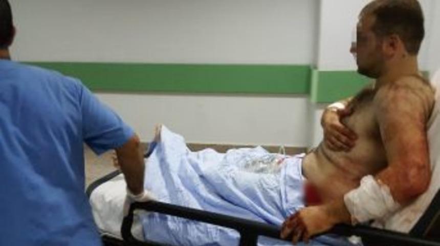 Bı&ccedil;aklı Saldırıda Ağır Yaralandı