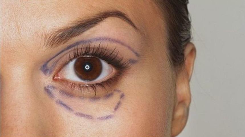 G&ouml;z &Ccedil;evresi Sorunları Yaşlı G&ouml;steriyor