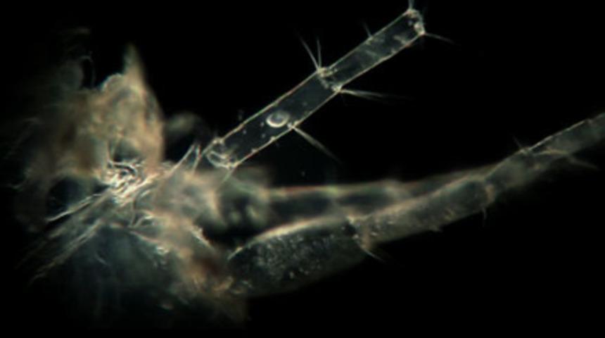 Bir damla sudaki canavarlar!