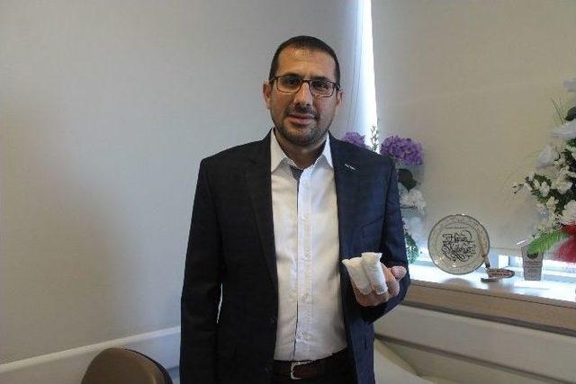 Kopan İki Parmağı Ameliyatla Yerine Dikildi 1