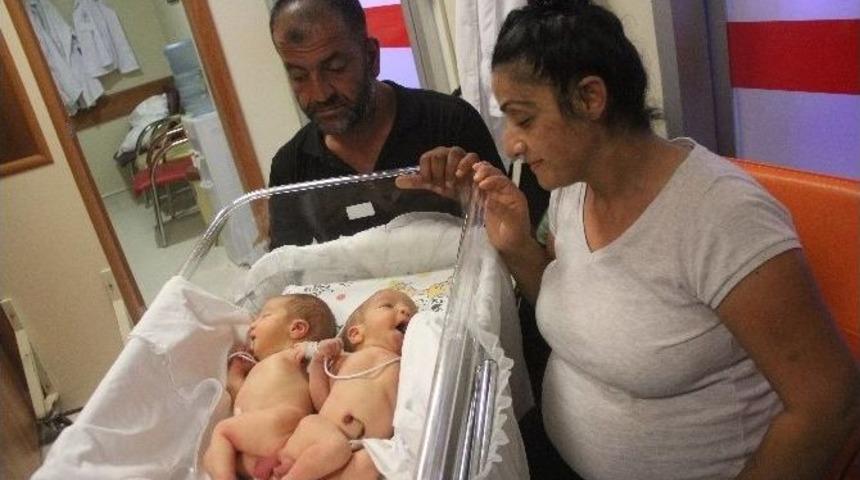 Hatay&rsquo;da Yapışık İkizler D&uuml;nyaya Geldi