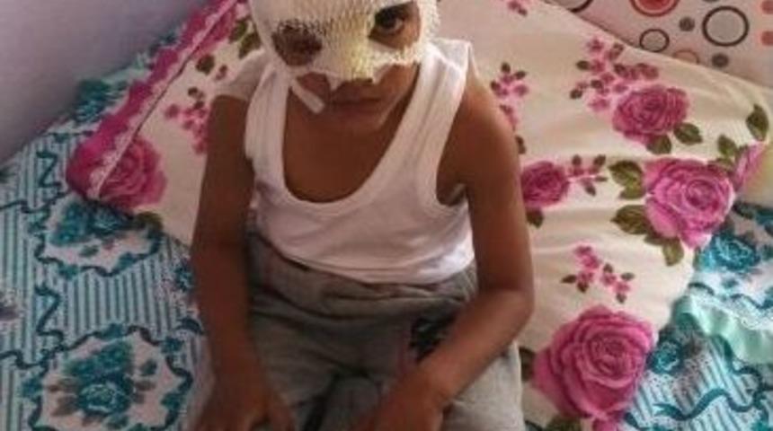 Evinin &Ouml;n&uuml;nde Oynarken K&ouml;peğin Saldırısına Uğradı