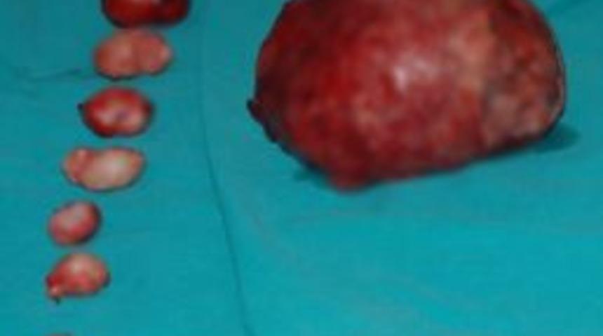 Rahminden 11 Tane Miyom Çıkarıldı