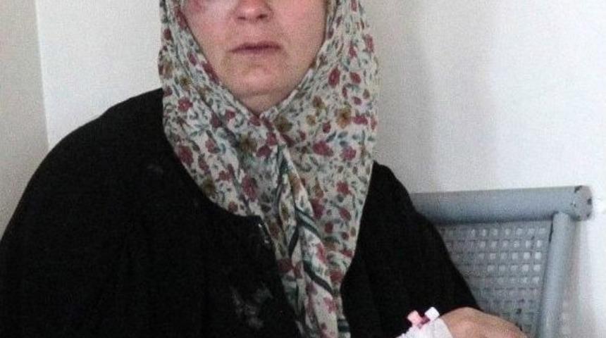 K&uuml;pesini Vermeyince Kocası Darp Etti