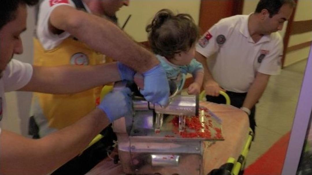 (&ouml;zel Haber) Kolunu Kaptırdığı Kıyma Makinesiyle Hastaneye Getirildi