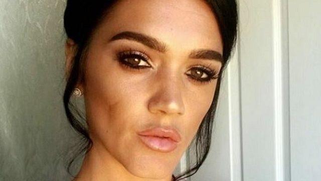 Brezilya tipi kalça kaldırma ameliyatı riske değer mi? 1