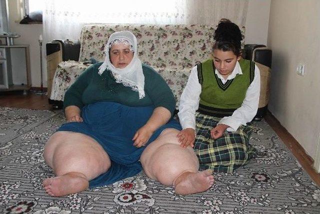 ‘fil’ Hastası Anne Eve Hapsoldu 2