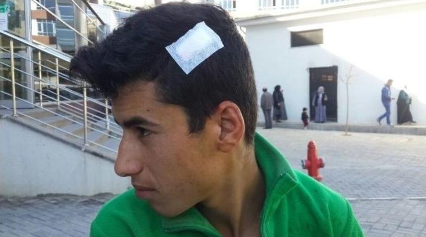 Suriyeli &Ccedil;ocuğun Kafasında Fayans Kırıldı