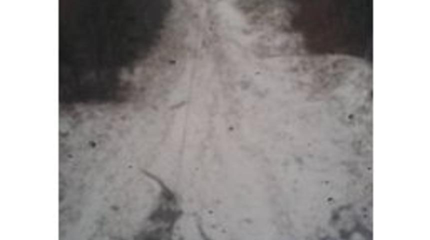 Uludağ Gelinliğini Giydi