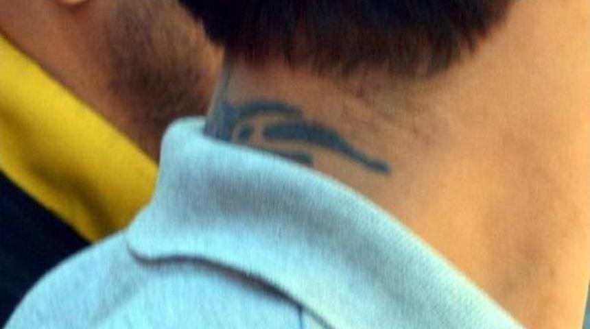 Kapka&ccedil;&ccedil;ı Ensesindeki D&ouml;vmeden Yakalandı