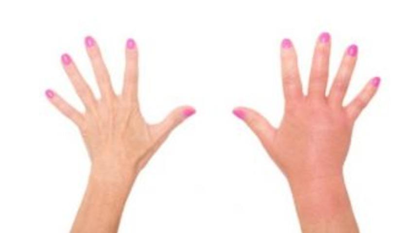 &Ouml;dem Yapan Besinlere Dikkat