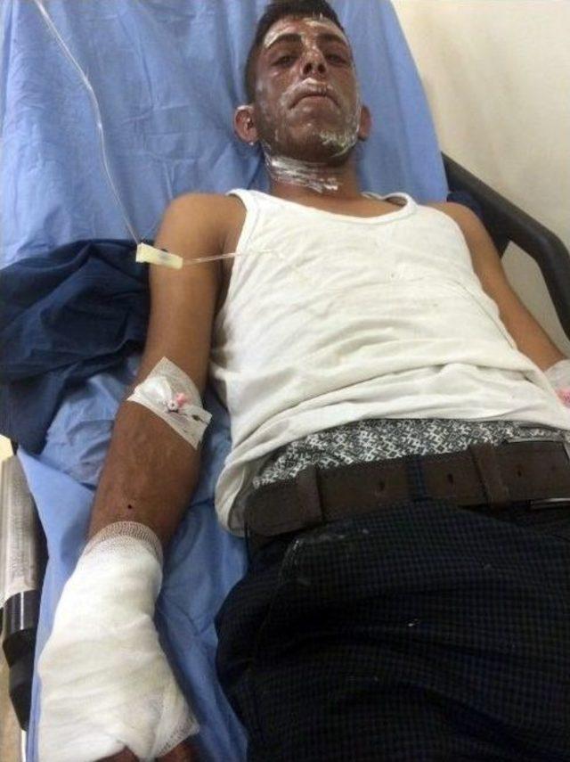 Alev Topuna D&ouml;nen Otomobilden Hafif Yanıklarla Kurtuldular 3