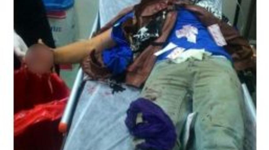 Polise Atmak İstediği Bomba Elinde Patladı