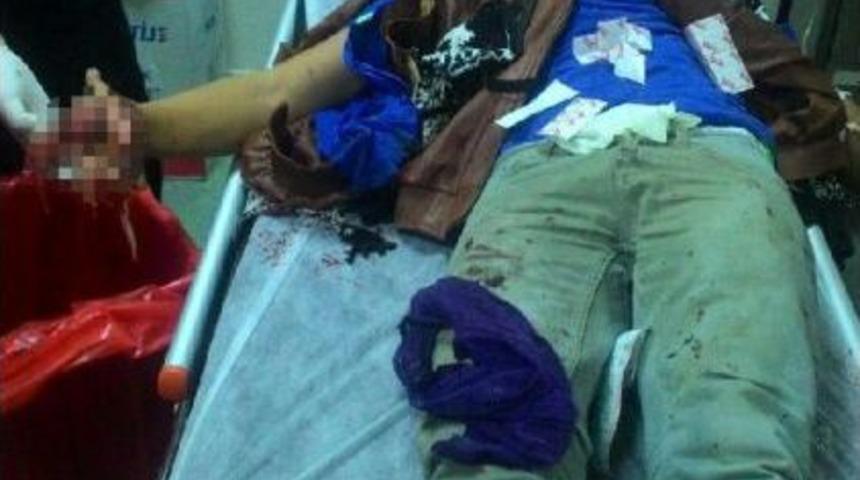 Polise Atmak Istediği Bomba Elinde Patladı