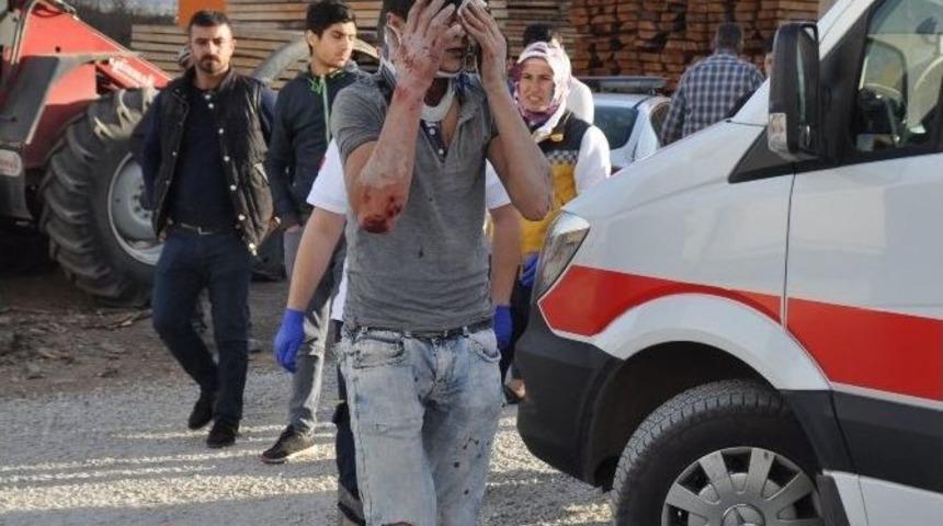 Kamyonun Altından Sağ &Ccedil;ıktılar