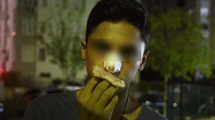 Babasının D&ouml;vd&uuml;ğ&uuml; Kızı Teselli Eden &Ccedil;ocuğun Burnunun Kırıldığı İddiası