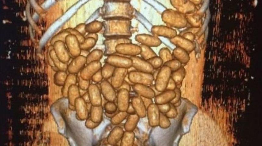 Sindirim Sistemlerinden Uyuşturucu &Ccedil;ıktı