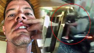 Alp Kırşan'ın zor anları! Sevenlerini korkuttu