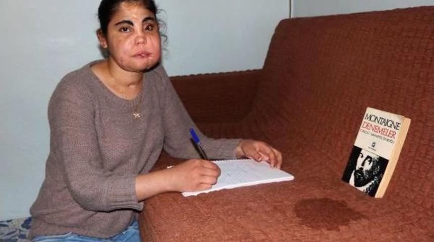 T&uuml;rkiye'de Y&uuml;z Nakli Olan Ilk Kadın &Ouml;ld&uuml;