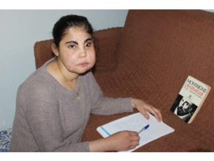 Türkiye’nin Yüz Nakli Yapılan İlk Kadını Hayatını Kaybetti